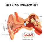 anatomy ear tinnitus
